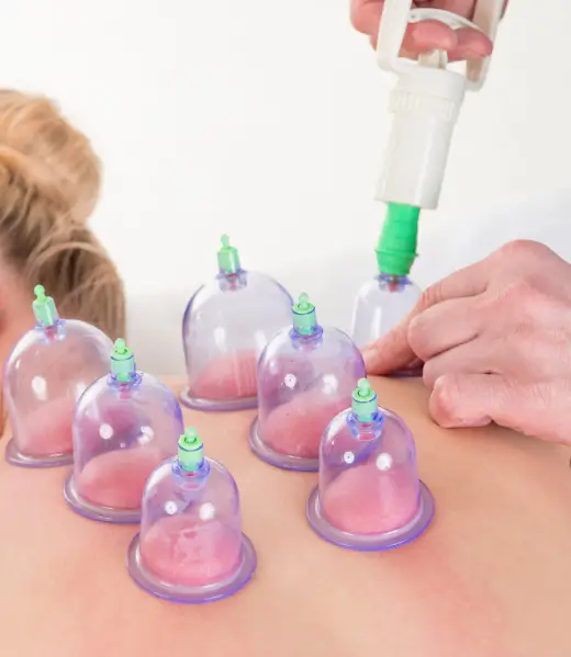 Cupping Treatment in Jaipur